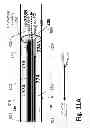 Fig. 32 - Ballooned ventilation tube cleaning device