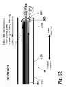 Fig. 35 - Ballooned ventilation tube cleaning device