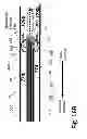 Fig. 40 - Ballooned ventilation tube cleaning device
