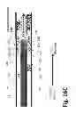 Fig. 41 - Ballooned ventilation tube cleaning device