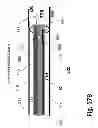 Fig. 44 - Ballooned ventilation tube cleaning device