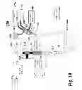 Fig. 45 - Ballooned ventilation tube cleaning device