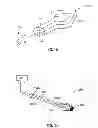 Fig. 09 - SYSTEMS AND METHODS FOR TREATMENT OF SLEEP APNEA