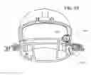 Fig. 07 - PROTECTIVE MOUTH GUARD