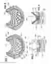 Fig. 02 - Method for mass transfer of micro-patterns onto medical devices