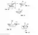 Fig. 06 - Method for mass transfer of micro-patterns onto medical devices