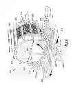 Fig. 07 - Magnetic drum separator with an outer shell having traction elements