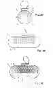 Fig. 09 - Element for eliminating turbulent behavior of liquid in a holder