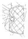 Fig. 06 - Vehicle Beverage Shield