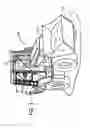 Fig. 02 - ROPS mount for work vehicle display interface