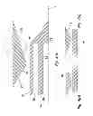 Fig. 04 - Mist generating apparatus and method