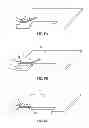 Fig. 05 - Semiconductor device and method of assembling same