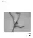 Fig. 06 - Blood vessel model comprising polyvinyl alcohol and silica particles