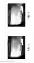 Fig. 09 - METHOD AND APPARATUS FOR FORMING NANO-PARTICLES