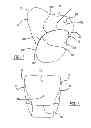 Fig. 02 - Tether airbag control system