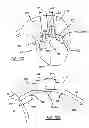 Fig. 07 - Tether airbag control system