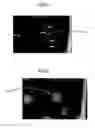 Fig. 03 - ATTACHED MATTER DETECTOR, AND ATTACHED MATTER DETECTION METHOD
