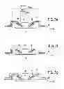 Fig. 05 - Pre-collapsed capacitive micro-machined transducer cell with plug