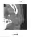 Fig. 04 - Method and apparatus for learning-enhanced atlas-based auto-segmentation