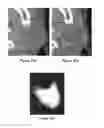 Fig. 08 - Method and apparatus for learning-enhanced atlas-based auto-segmentation
