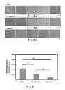Fig. 03 - Biodegradable, non-thrombogenic elastomeric polyurethanes