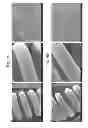 Fig. 05 - Biodegradable, non-thrombogenic elastomeric polyurethanes