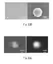 Fig. 14 - Biodegradable, non-thrombogenic elastomeric polyurethanes