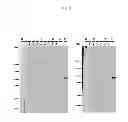 Fig. 05 - Antibody against mutant α-actinin-4