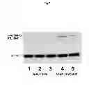 Fig. 09 - Antibody against mutant α-actinin-4
