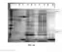 Fig. 45 - Recombinant proteins and their therapeutic uses