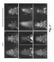 Fig. 03 - Manganese ion coated nanoparticles for delivery of compositions into the central nervous system by nasal insufflation