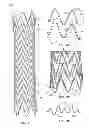 Fig. 02 - Process of making a stent