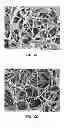 Fig. 09 - Process of making a stent