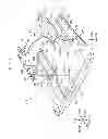 Fig. 08 - Dissimilar-material welded structure and welding method therefor