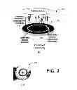 Fig. 03 - Multifunctional oral prosthetic system