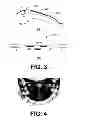 Fig. 04 - Multifunctional oral prosthetic system