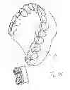 Fig. 17 - Dental tool and guidance devices