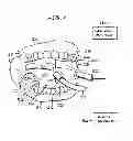 Fig. 02 - Intraoral device adapter