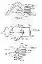 Fig. 05 - Intraoral device adapter