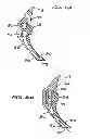 Fig. 06 - Intraoral device adapter