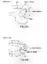 Fig. 09 - METHODS AND DEVICES FOR INTRAORAL TACTILE FEEDBACK