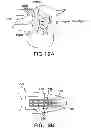 Fig. 22 - METHODS AND DEVICES FOR INTRAORAL TACTILE FEEDBACK