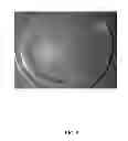 Fig. 07 - GOLD NANOPARTICLE BASED DIPSTICK NANO-BIOSENSOR FOR DETECTING PLASMODIUM FALCIPARUM AND PLASMODIUM VIVAX AND MEHTOD OF SYNTHESIZING THE SAME