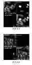 Fig. 05 - Method for producing insoluble aggregate of neurodegenerative-disease-related protein