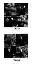 Fig. 06 - Method for producing insoluble aggregate of neurodegenerative-disease-related protein