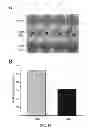 Fig. 13 - Compositions and methods for collecting algae