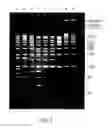 Fig. 03 - NUCLEIC ACID LADDERS