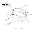Fig. 06 - Light bulb socket having a plurality of thread locks to engage a light bulb