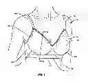 Fig. 02 - Upper and lower torso garments having an improved band