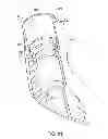 Fig. 40 - Interchangeable shaft system